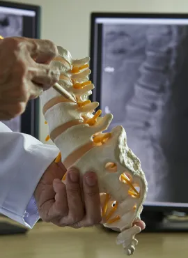 Cirugía columna Cirugía de Tumor en Médula Espinal en Culiacán