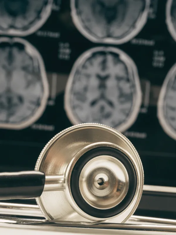Enfermedades Cerebrales neurocirujano