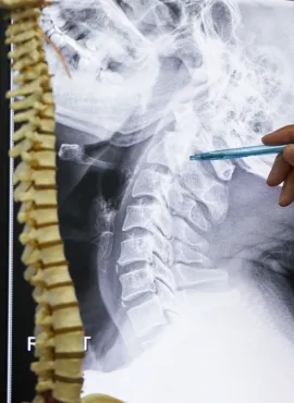 especialista Cirugía de columna Doctor Especialista en Columna En Culiacán
